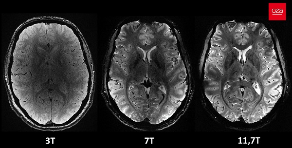 Porovnanie snímok ľudského mozgu zachytených novým MRI prístrojom Iseult pri rôznych úrovniach výkonu - 3 T, 7 T a 11,7 T. Všetky boli zhotovené za rovnaký čas, čo dokazuje, koľko detailov možno zachytiť pri vyššom výkone.