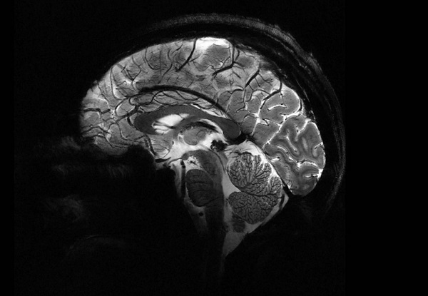 Snímka ľudského mozgu zachytená novým MRI prístrojom Iseult pri výkone 11,7 Tesla, ktorá ukazuje úroveň možných detailov.