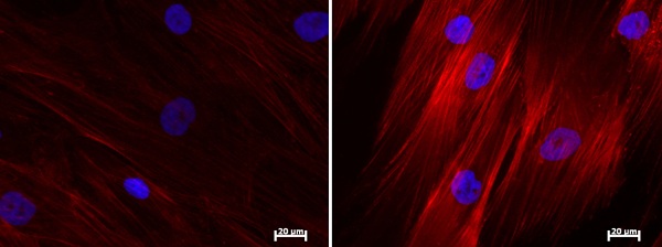 Vedci vložením génu Nanog dokázali reštartovať regeneráciu starších kmeňových buniek