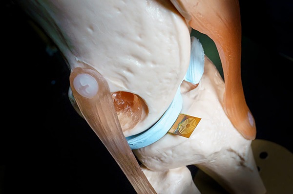 Zariadenie ForceSticker bolo úspešne otestované na modeli kolenného kĺbu.