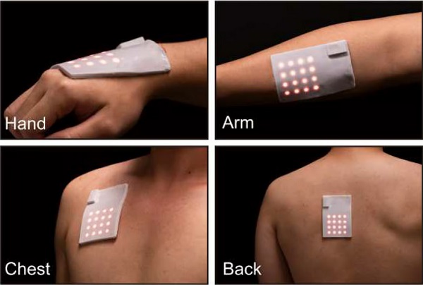 Mäkkú, flexibilnú náplasť elektronickej kože možno nosiť na akejkoľvek časti tela - na dvoch alebo viacerých osobách.
