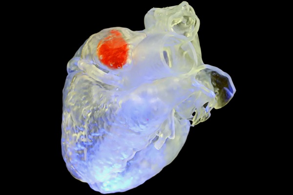 Stuhnutá štruktúra sono atramentu (červená) vytlačená vo vnútri modelu srdca.