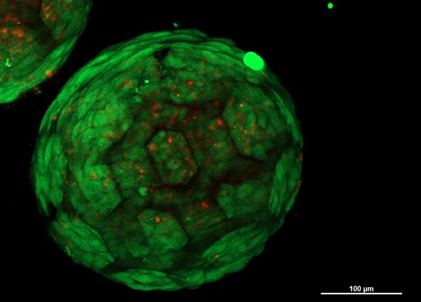 Detailný mikroskopický obraz sféroidu obsahujúceho kmeňové bunky chrupavky.