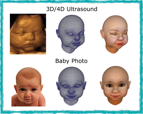 3D Babies vám vytlači z ultrazvuku figúrku 3D dieťaťa