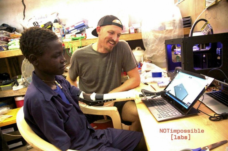 Mick Ebling pomáha Danielovi so zaobchádzaním s 3D protézou