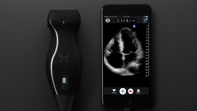 Zariadenie Butterfly iQ chce priniesť ultrazvukovú technológiu lekárom priamo do vrecka a to za menej ako 2 000 dolárov.