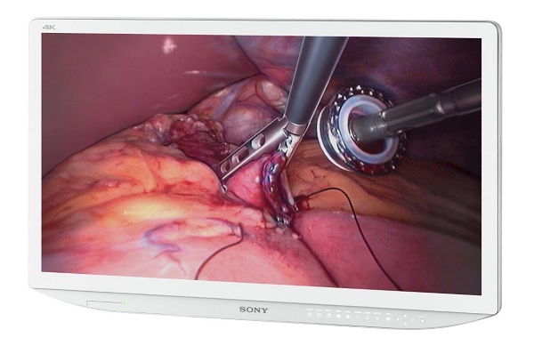 Lekárske monitory Sony v sebe spájajú vysoké rozlíšenie 4K s technológiou 3D zobrazenia