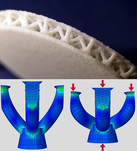 3D tlačená ortopedická vložka do topánok pre diabetikov môže mať presne definované tuhá a mäkké časti presne podľa tlakových bodov pacienta