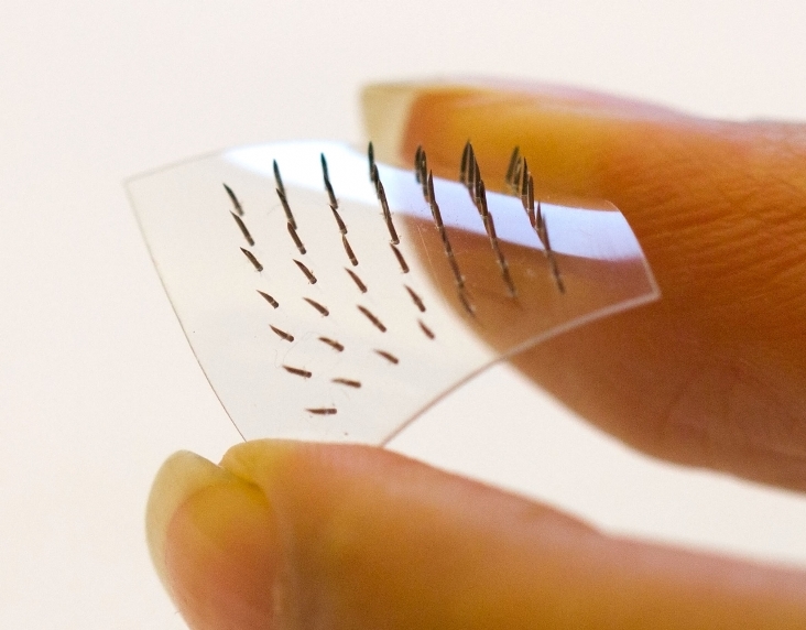 Vedci z KHT Kráľovského inštitútu pre technológie v Štokholme vyvinuli náplasť s mikroihlami, ktorá je vyrobená z dvoch materiálov 