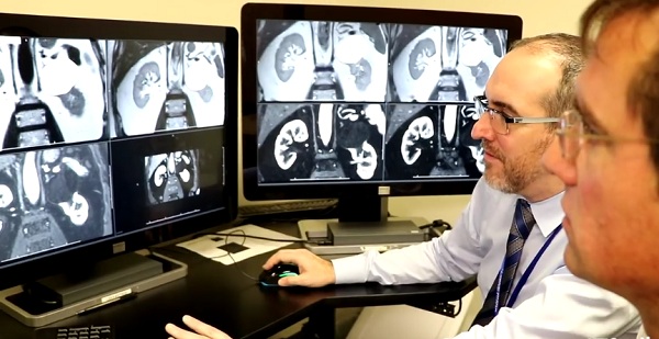 Vedci z univerzity Southwestern vyvinuli novú metódu, ktorá s pomocou MRI snímok zistí prítomnosť zhubného nádoru v obličkách.